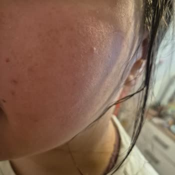 Şok Marketten Aldığım Son Kullanma Tarihi Geçmiş Ürünler Sağlık Sorunu Yarattı