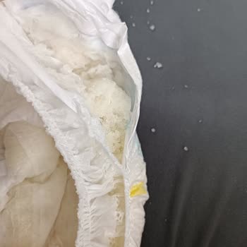 Molfix Külot Bezde Bant Ve Patlama Sorunu Yaşadım