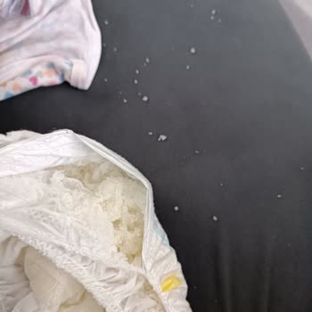 Molfix Külot Bezde Bant Ve Patlama Sorunu Yaşadım