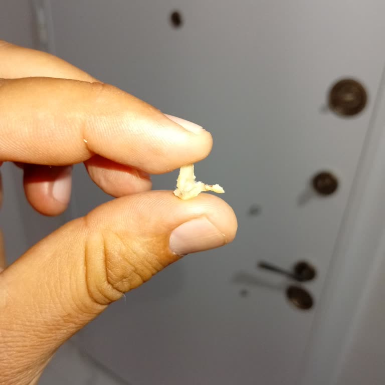 Denta Samsun Diş Çekimi Sırasında Dişimde Kemik Kaldı