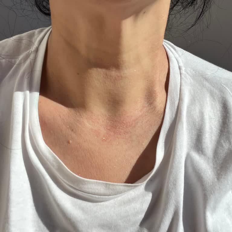 Yanlış Ürün Gönderimi Ve Alerji Yapan Kolyeler Mağduriyet Yaşattı