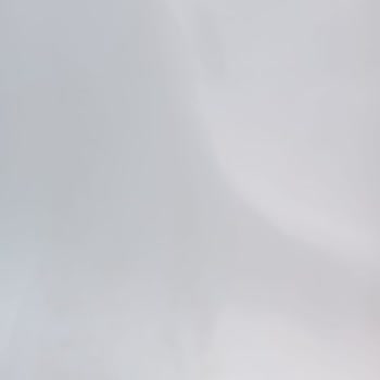 Fiat 3 Yıllık Araçta Boya Atması ve Garanti Dışı Bırakılması