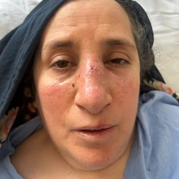 112 Acil Servis Görevlilerinin Yetersiz Ve Duyarsız Yaklaşımı