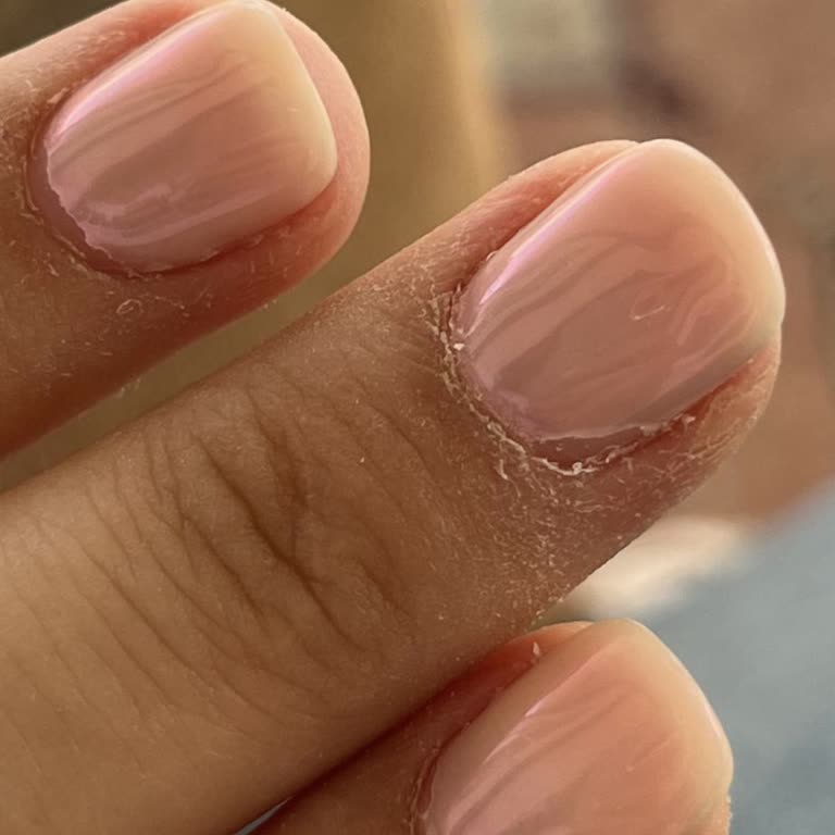 Yeni Yapılan Kalıcı Oje İkinci Günde Soyuldu, Mağduriyetim Giderilmeli