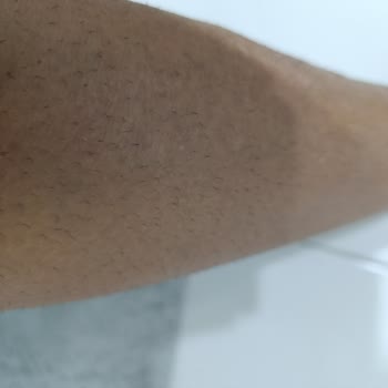 Kıl Çıkmama Garantisi Yerine Getirilmedi, Ürün İade Talebim Var