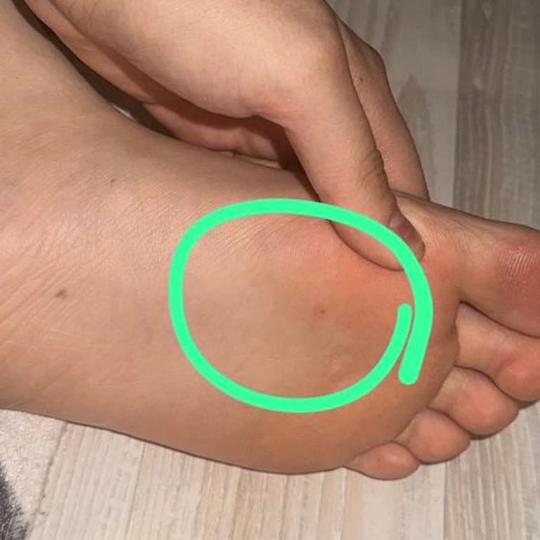 Koton Mağazasında Alarm İğnesi Nedeniyle Yaralanma Ve Mağduriyet