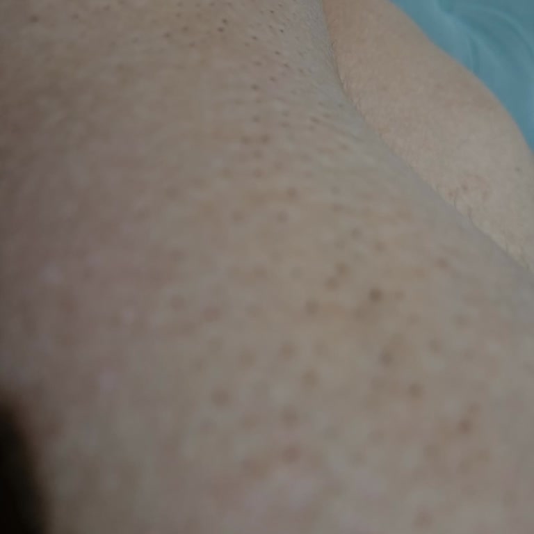 Restorex Şampuan Kullanımı Sonrası Şiddetli Kaşıntı Sorunu