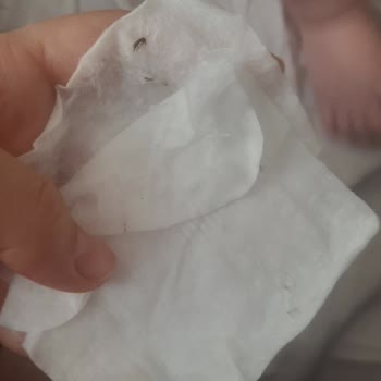 Bebek Pamuklarının İçinden Çıkan Yabancı Maddeler Endişelendiriyor