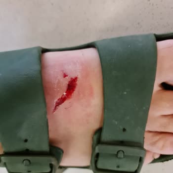 Decathlon Mağazada Güvenlik Eksikliği Nedeniyle Yaralanma Ve İlgisizlik