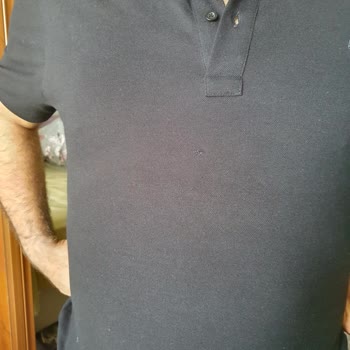 Defolu Ürün Gönderimi Ve Zahmetli İade Süreci