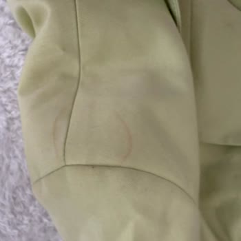 Gardrops Açıklamasıyla Uyuşmayan Ürün Ve Yetersiz Müşteri Desteği Hayal Kırıklığı Yarattı