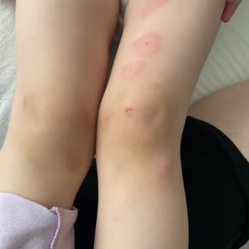 İncia İncia Sivrisinek Kovucu Losyon Beklentileri Karşılamıyor