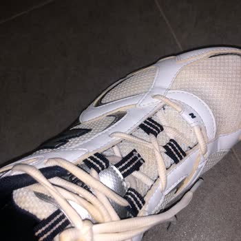 Yeni Alınan Ayakkabıda Kısa Sürede Sararma Sorunu