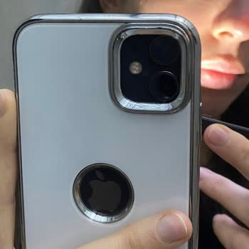 Uzm. Dr. Kenan Keskin Burun Dolgusu Yaptırdım Burun Ucundaki Kızarıklık Geçmedi