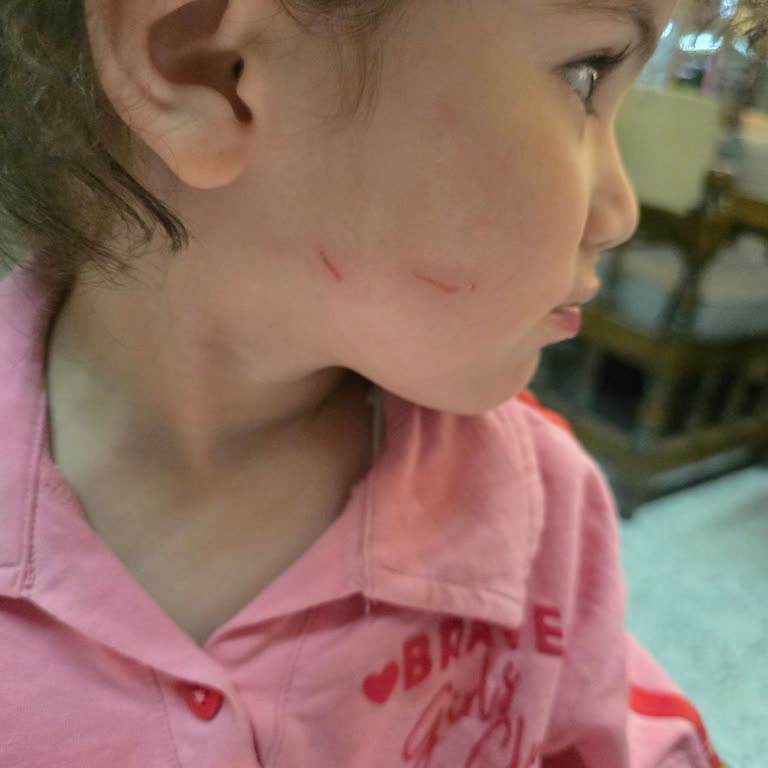 Opsco Play Kids Çocuk Oyun Alanında Yetersiz Gözetim Sonucu Fiziksel ve Psikolojik Zarar