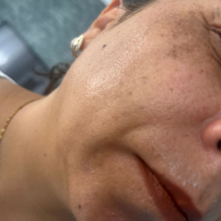 Güneş Kremi Yüzümde Soyulma Ve Akma Yaptı, İade Alınmadı