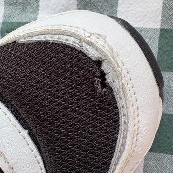 Kısa Sürede Deforme Olan Skechers Ayakkabı Ve Yetersiz İnceleme Süreci