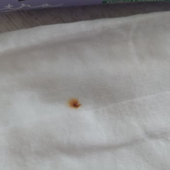 Sleepy Temizlik Havlusunda Lekeli Ürün Problemi Ve Güven Kaybı