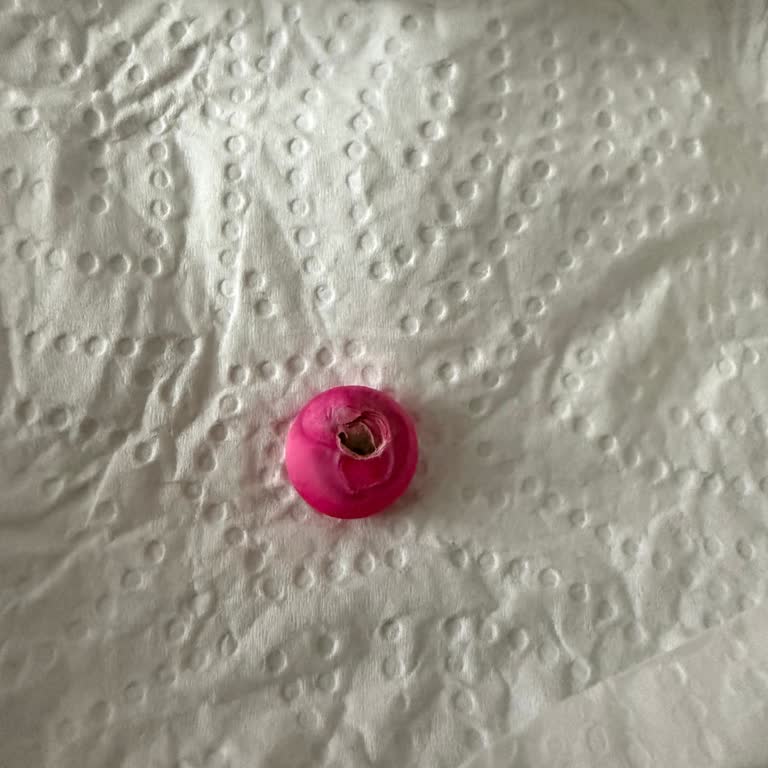 Gyno Ferro İlacında Bozulma Ve Metalik Tat Sorunu