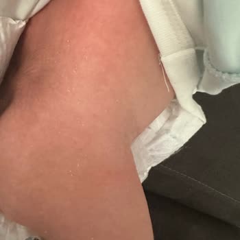 Molfix 3 Numara Bebek Bezinde Kristal Parçalar Endişesi