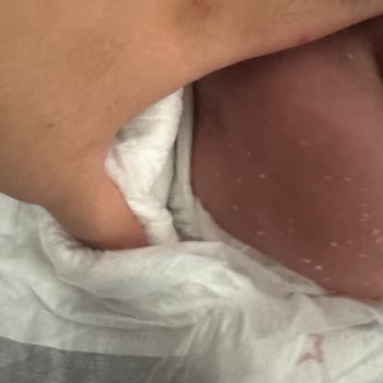 Molfix 3 Numara Bebek Bezinde Kristal Parçalar Endişesi