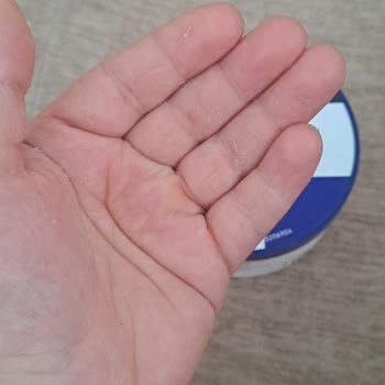 Neutrogena Yoğun Nemlendirici Ciltte Soyulma Ve Yapışkanlık Sorunu