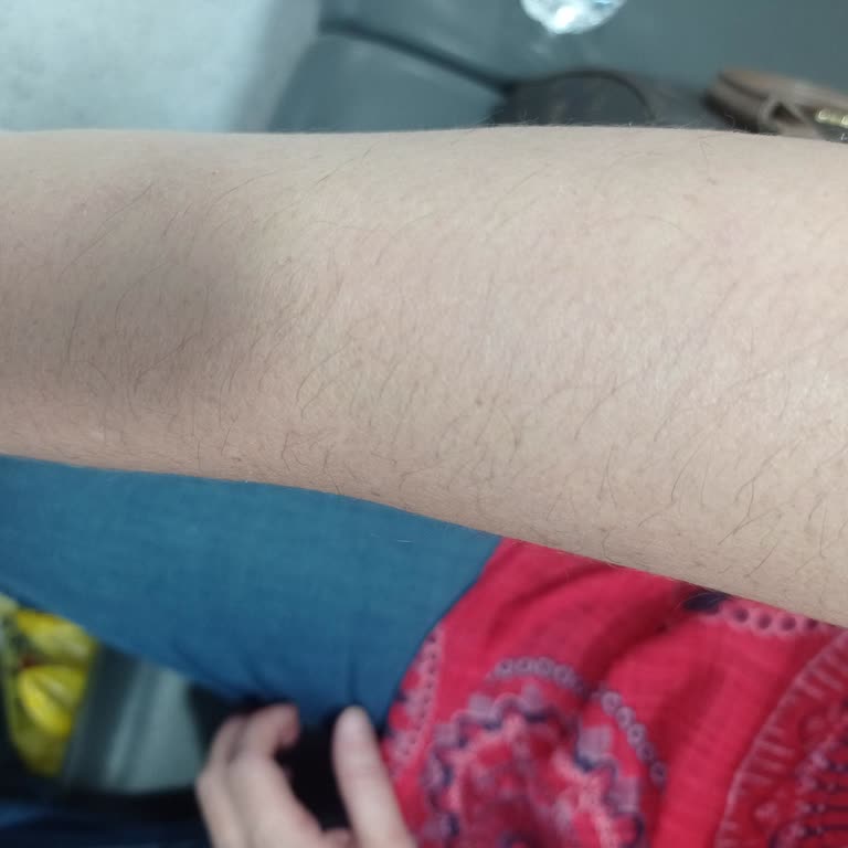 Vaat Edilen Sonuçlardan Uzak, Hayal Kırıklığı Yaratan Epilasyon Deneyimi