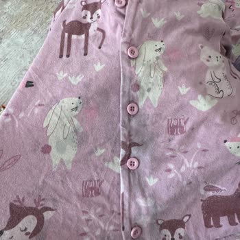 Çamaşır Makinesi Kıyafetlerimi Sürekli Lekeliyor, Servis Çözüm Sunmuyor