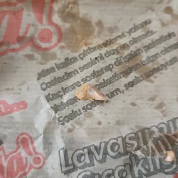 Dönerden Çıkan Kemik Ve Şubenin İlgisizliği Sağlığımızı Tehdit Etti