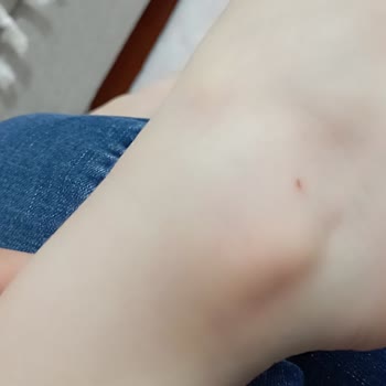 Çöp Konteyneri Nedeniyle Hijyen Ve Sağlık Sorunları Yaşıyoruz