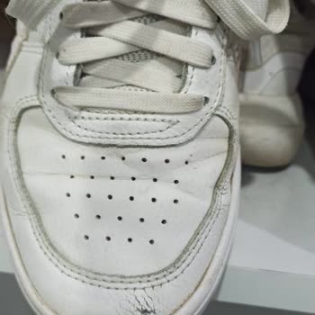 Aldığım Ayakkabının Önleri Kısa Sürede Patladı