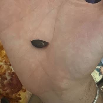 Domino's Siparişimde Zeytin Çekirdeği Çıktı, Dişim Kırıldı