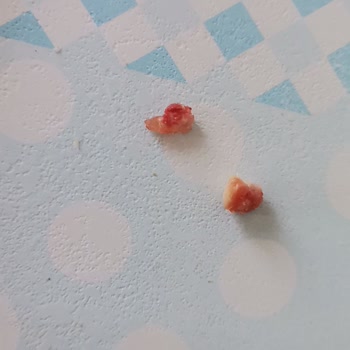 Pahalı Sucukta Kemik Parçaları Ve İlgisiz Müşteri Hizmeti