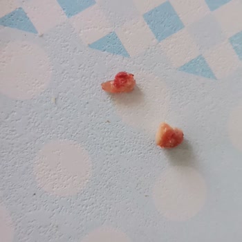 Pahalı Sucukta Kemik Parçaları Ve İlgisiz Müşteri Hizmeti