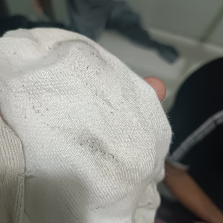 Ayakkabı Astarı Boyası Nedeniyle Ayaklarım Ve Çoraplarım Kararıyor