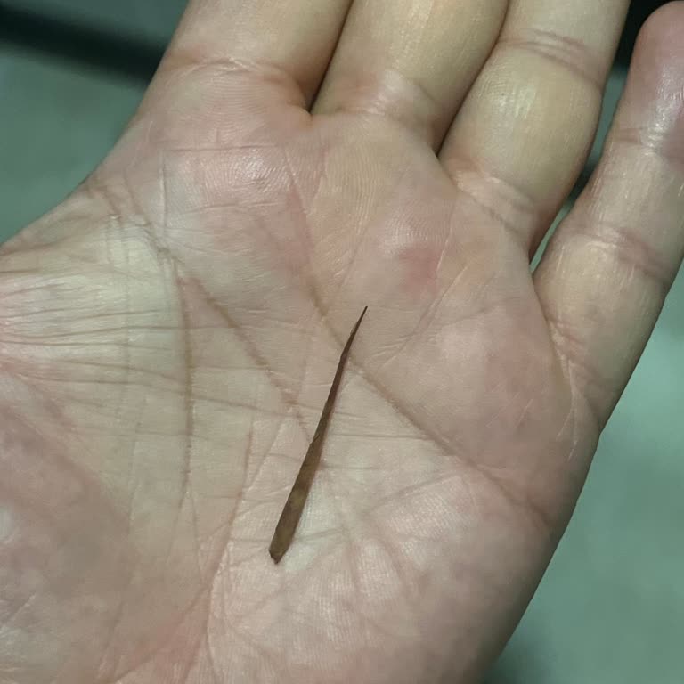 Siparişimde Tahta Parçası Çıktı, Ücret İadesi Sorunu Yaşadım