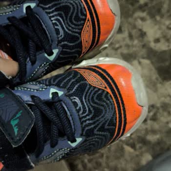 Aldığım Skechers Ayakkabı 1 Ayda Bozuldu, Garanti Süreci Hayal Kırıklığı