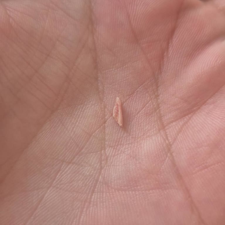 Erpiliç Tavuk Sucuğunda Tırnak Benzeri Sert Madde Çıktı