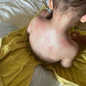 Risus Beach Resort Hotel Kuşadası Aile Tatilinde Hijyen Ve Güvenlik Skandalı