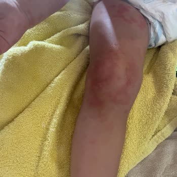 Risus Beach Resort Hotel Kuşadası Aile Tatilinde Hijyen Ve Güvenlik Skandalı