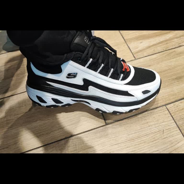 Skechers Ayakkabıda Kısa Sürede Yaşanan Astar Yırtılması Ve Müşteri Hizmetlerinde Hayal Kırıklığı