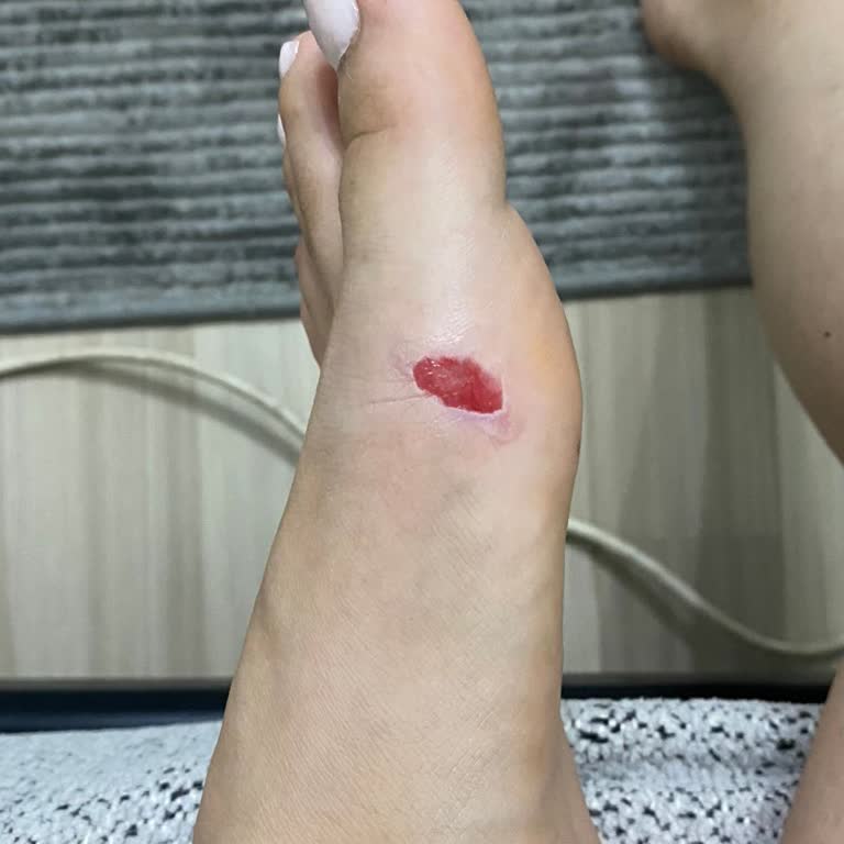 Aldığım Terlik Ayaklarımı Mahvetti Yürümekte Zorlandım