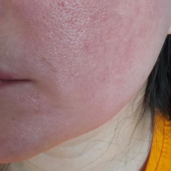 I Used L'Oréal Paris Bright Reveal and It Instantly Turned My Skin Red