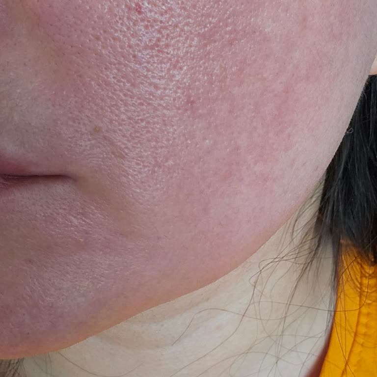 I Used L'Oréal Paris Bright Reveal and It Instantly Turned My Skin Red