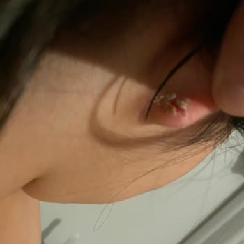 Çocuk Küpesi Tasarım Hatası Nedeniyle Sağlık Riski Ve Yetersiz Mağaza Çözümü