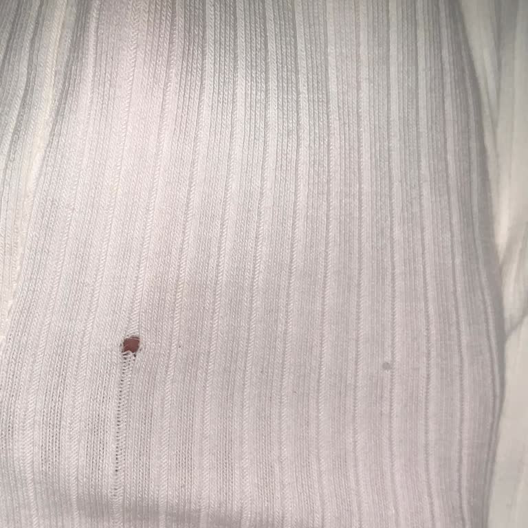 Stradivarius'tan Defolu Gelen Tişört İçin İade Ve Destek Sorunu