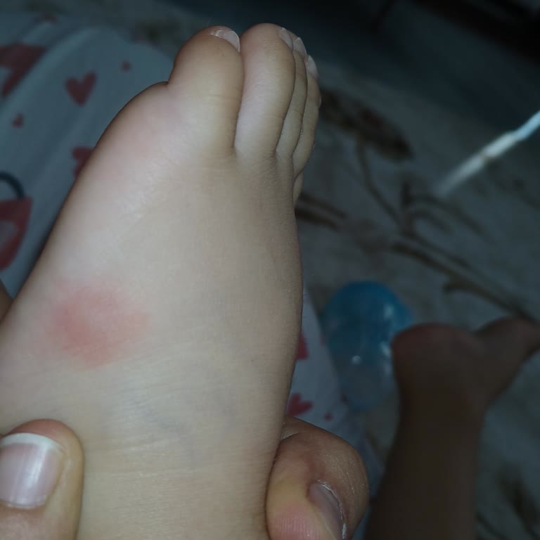 Samanlı Mahallesinde İlaçlama Eksikliği Haşere İstilasına Yol Açıyor