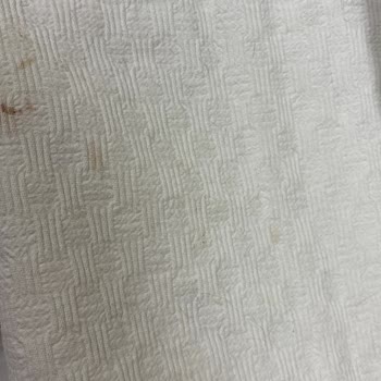 Pamukkale Üniversitesi Hastanesi Atom Tedavisinde Yaşanan Aksaklıklar Ve Hijyen Sorunları