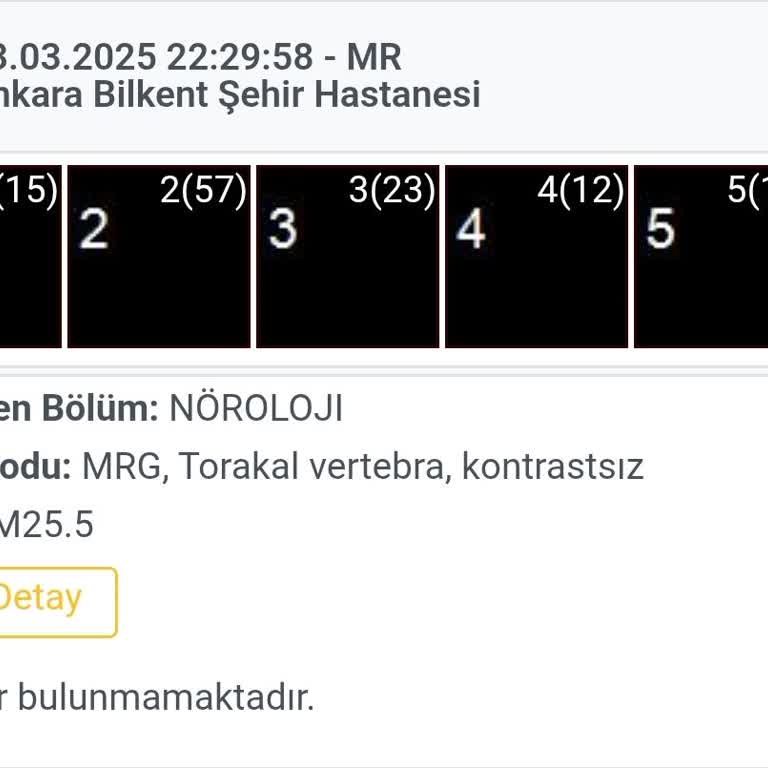 MR Raporunun Aylarca Hazırlanamaması Ve İlgisiz Personel