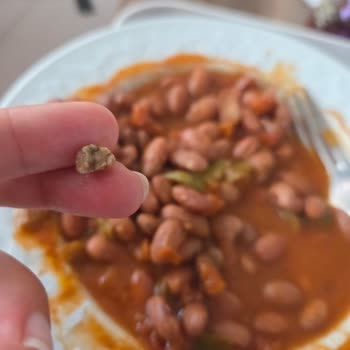 Tamek Barbunya Pilaki'den Çıkan Taş Sağlığımı Tehdit Etti